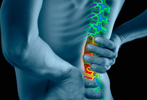 hosszan tartó hátfájás hogyan kell kezelni a gerinc mellkasi osteochondrosisát